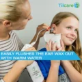 Tilcare Ear Wax Removal Tool easily flushes the ear wax with warm water