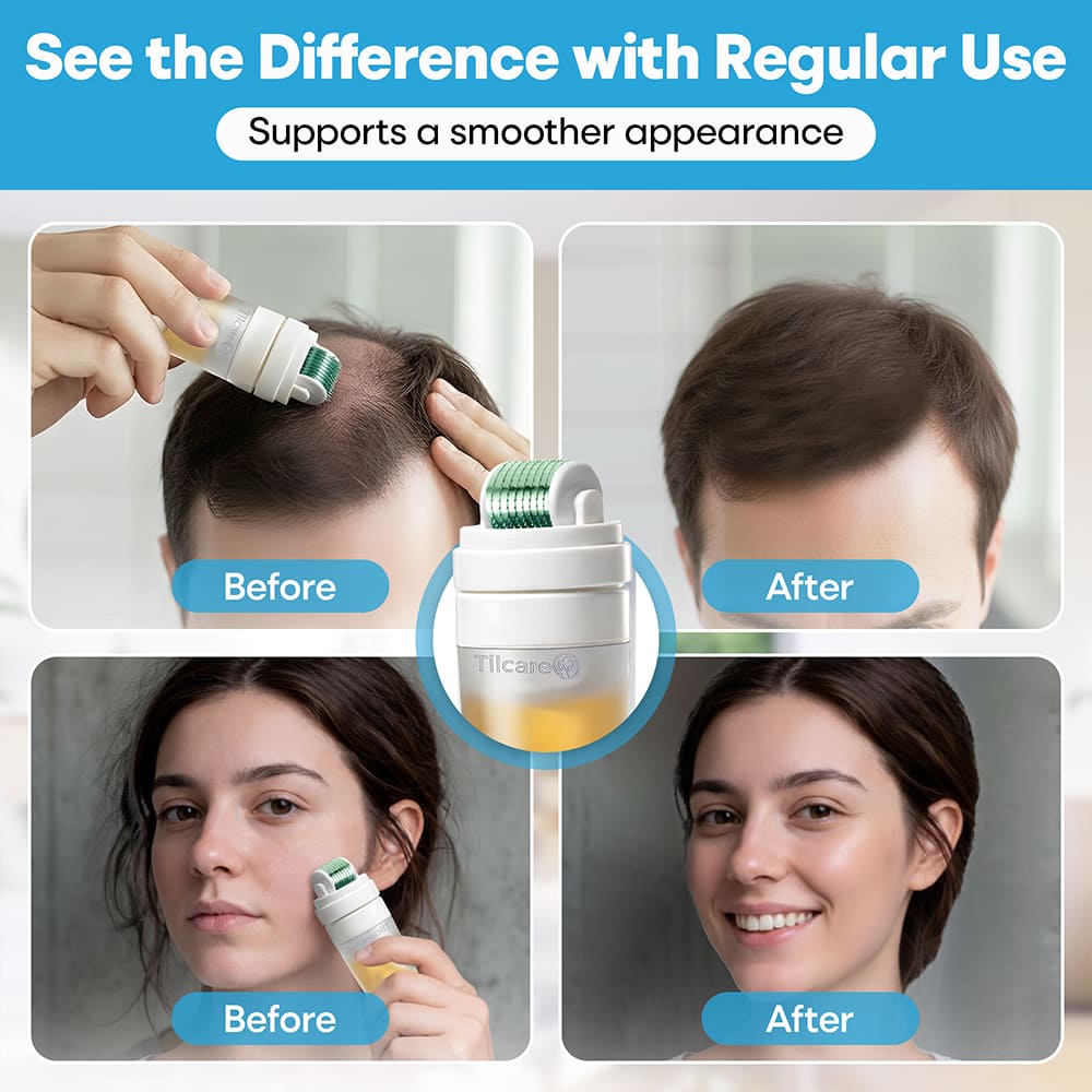 5-2 Derma Roller support a smoother appearance